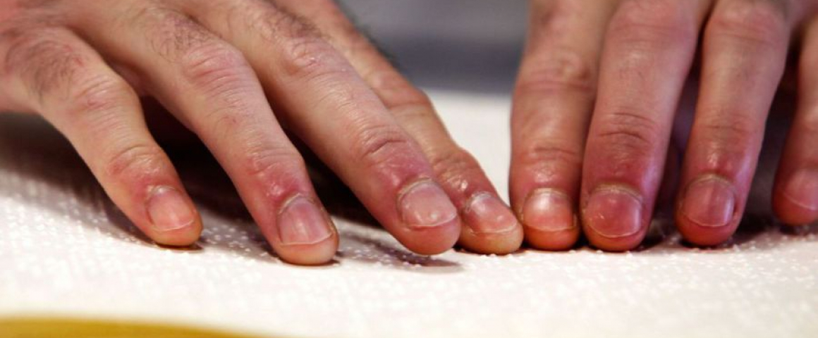 Angola produz manuais em braille para o ensino especial