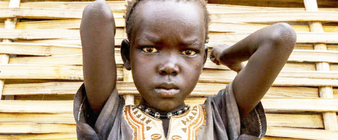 Campanha de desparasitação na Guiné-Bissau