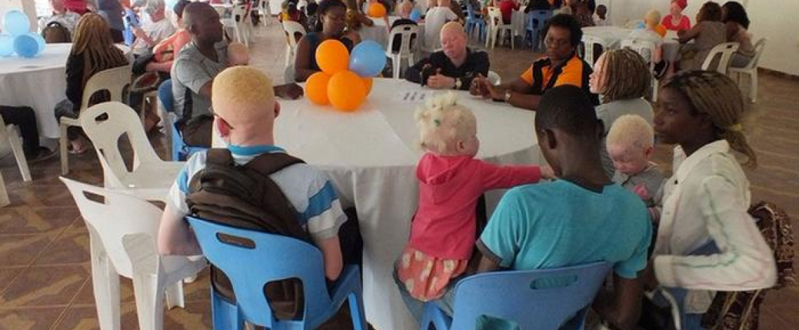 Albinos beneficiam de consultas oftalmológicas gratuitas em Moçambique