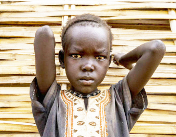 Campanha de desparasitação na Guiné-Bissau