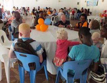 Albinos beneficiam de consultas oftalmológicas gratuitas em Moçambique